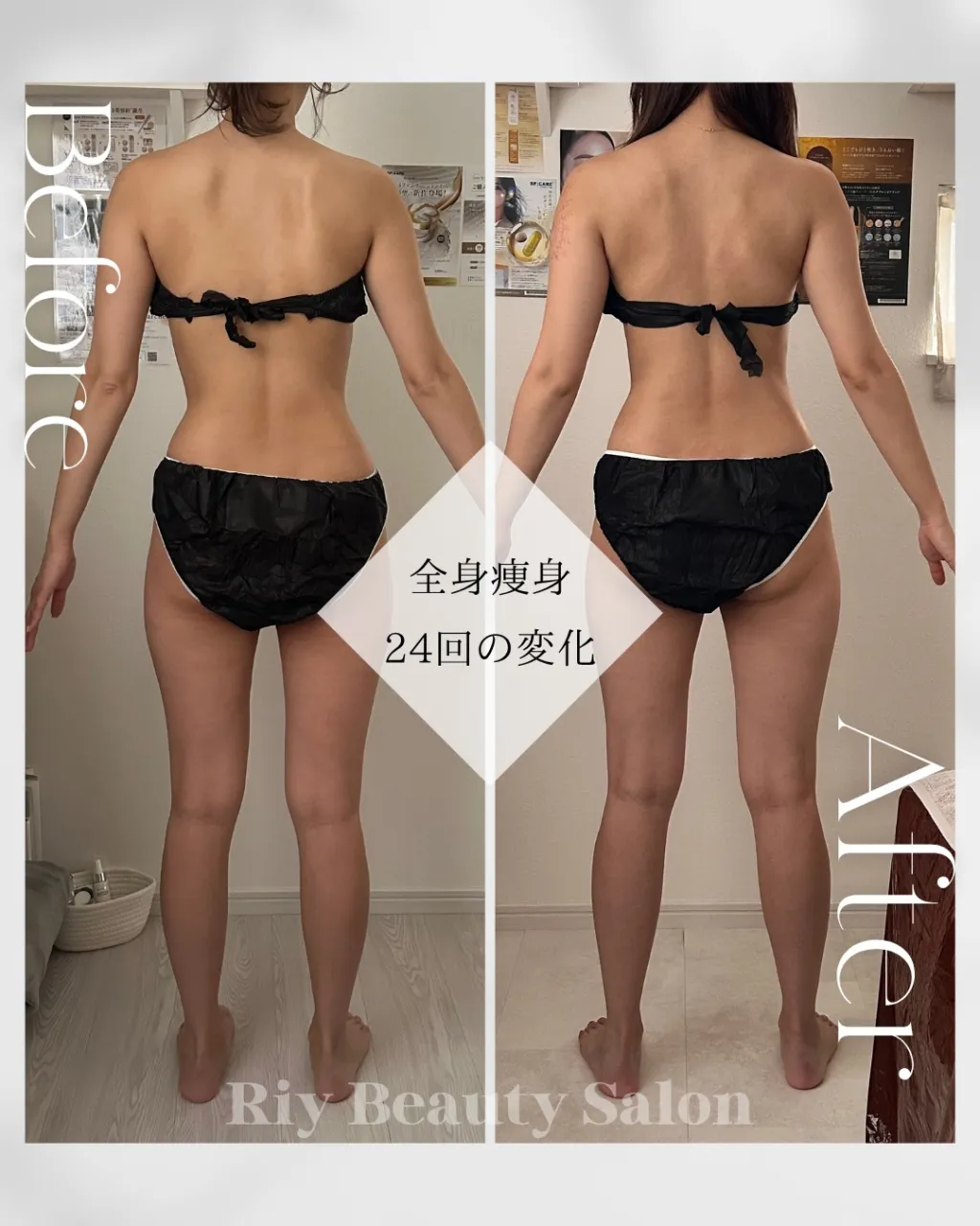 【 全身痩身24回目の変化❤️‍🔥✊🏻 】